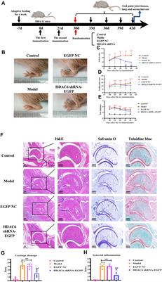 Novel mechanistic study of HDAC6 regulation of rheumatoid arthritis via CMA: exploring potential therapeutic targets